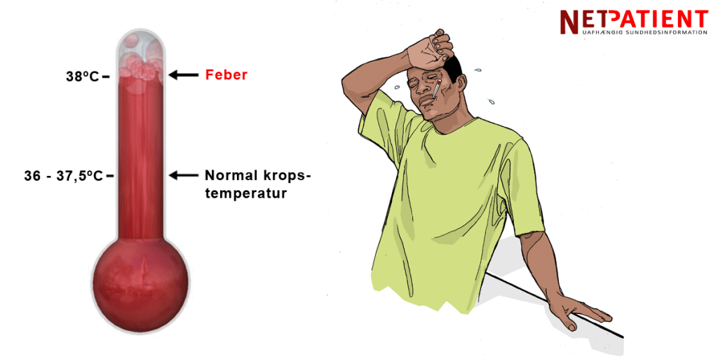 Feber er, når kropstemperaturen stiger til 38 grader eller derover