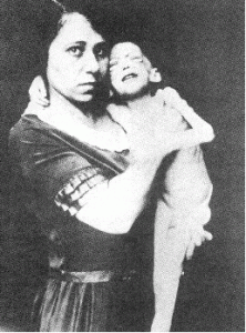 En dreng før insulinbehandling